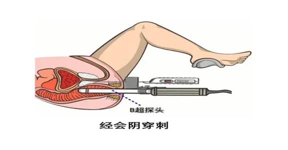640 (1).webp.jpg