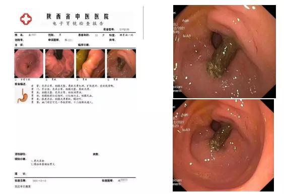 1639969534409086425.jpg 1.jpg