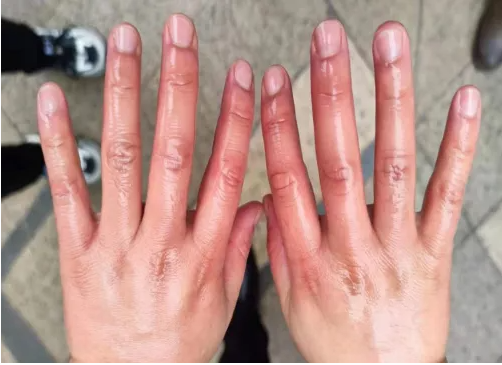 1643091058546005718.png image.png