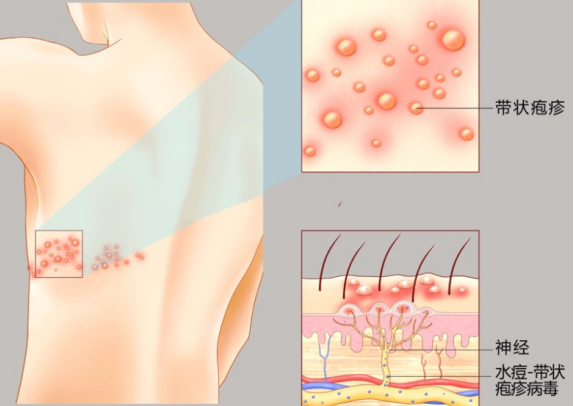 1647265517759017014.png 微信图片_20220314215600.png