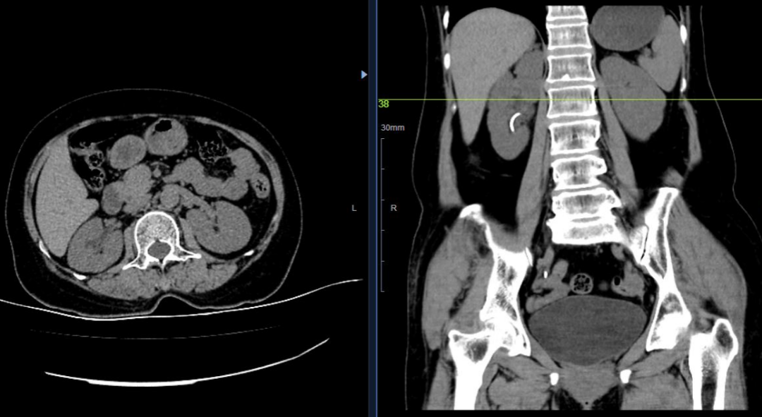 1651797632850069356.png 1651797632850069356.png