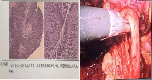 1651797660225038322.png 1651797660225038322.png