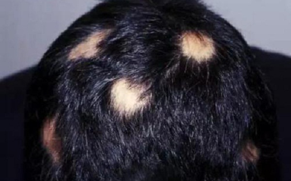 1654821881148048101.png 1654821881148048101.png