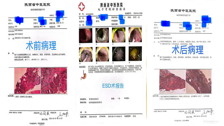 1688054745897018880.png 微信图片_20230630000741.png