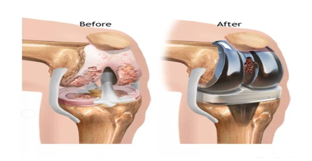 1699774798898013991.png 640 (24).png