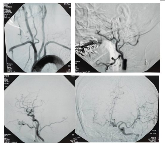 1700552284627041207.png 640 (1).png