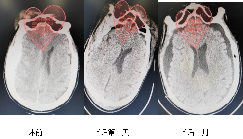 1705891121865067284.png 640 (11).png