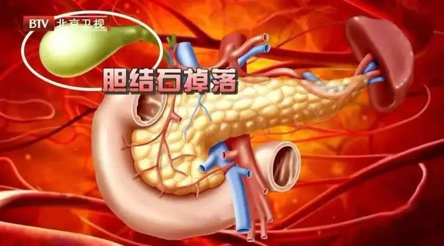 1725002633061011208.jpg a3.jpg